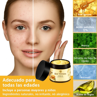 ✨¡BYE BYE IMPERFECCIONES CON BEE VENOM CREAM!🐝